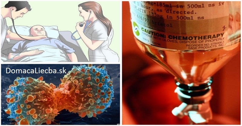 Najväčšie tajomstvo onkológie odhalené: Skutočná pravda o chemoterapii a ožarovaní