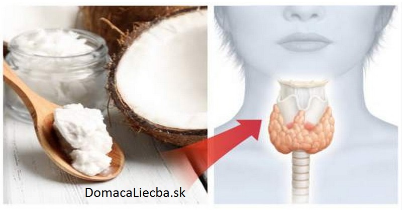 Vedeli ste, že kokosový olej dokáže vyliečiť štítnu žľazu? Stačí, že urobíte toto