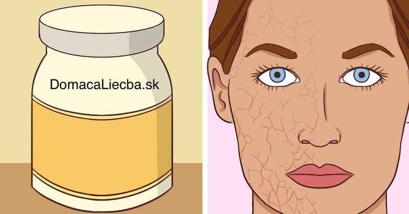 10 prírodných hydratačných látok na suchú a citlivú pokožku