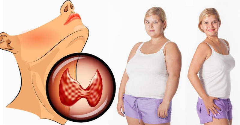 6 efektívnych spôsobov ako schudnúť pomocou diéty pri zníženej činnosti štítnej žľazy