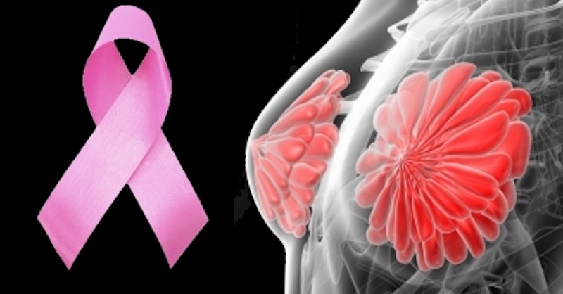9 najlepších potravín na prevenciu rakoviny prsníka