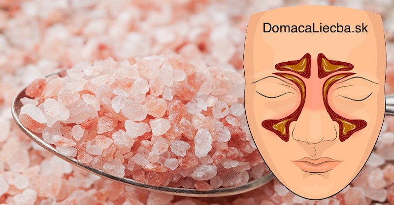 Inhalovanie tejto soli vám zastaví infekcie dutín, zníži hlieny a pomôže lepšie spať