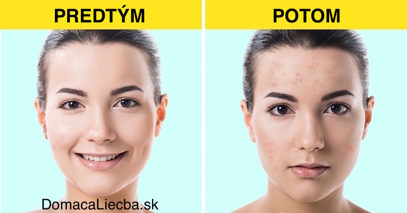 6 druhov kozmetiky, ktoré dermatológovia pridali na čierny zoznam