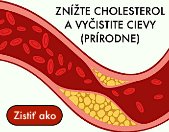 Cholesterol a cievy