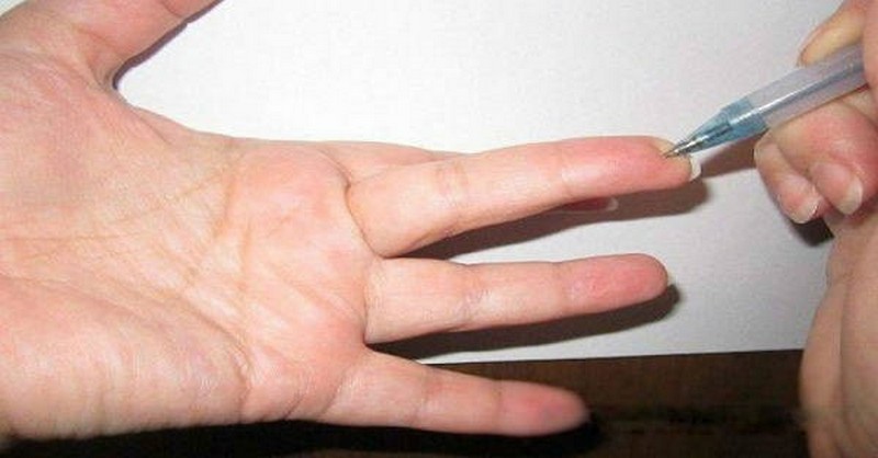 Špeciálny bod na prste, ktorý ihneď zníži krvný tlak a odstráni takmer každú bolesť