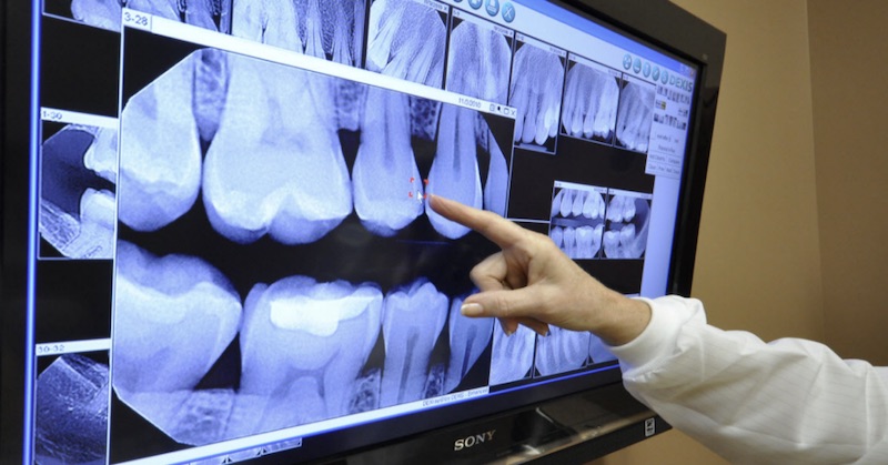 Prečo nedovoľte zubárovi pri prehliadke urobiť vám röntgen zubov