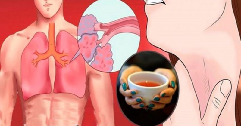 Pite tento čaj a rýchlo sa zbavte bolestí, zápalov a hlienov v pľúcach