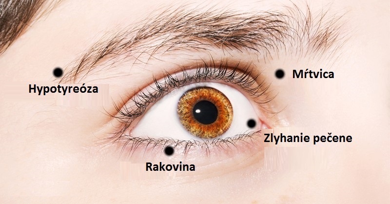8 skrytých alebo blížiacich sa ochorení, ktoré dokážete vyčítať z vašich očí