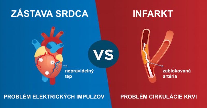 Aký je rozdiel medzi infarktom a zástavou srdca, ich príčiny a ako sa pred nimi chrániť