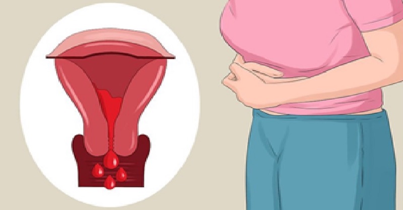 7 najčastejších príčin vynechanej alebo nepravidelnej menštruácie
