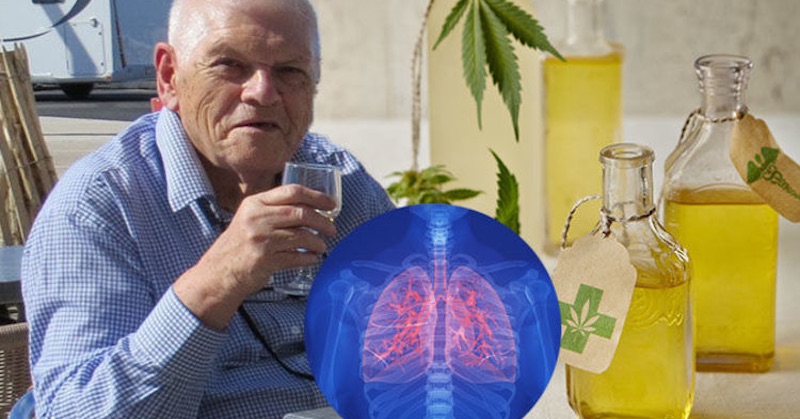 Bylinkový olej, čo dokázal zvrátiť rakovinu pľúc u 81 ročného muža