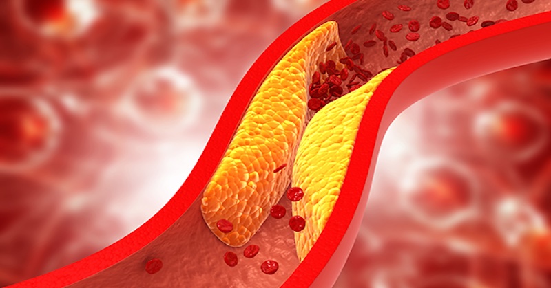 Prírodná látka, ktorá prirodzeným spôsobom znižuje hladinu zlého cholesterolu v krvi