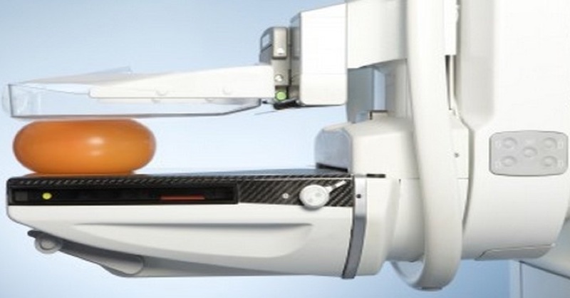 Ako röntgenové žiarenie z mamografov pomáha šíriť epidémiu rakoviny