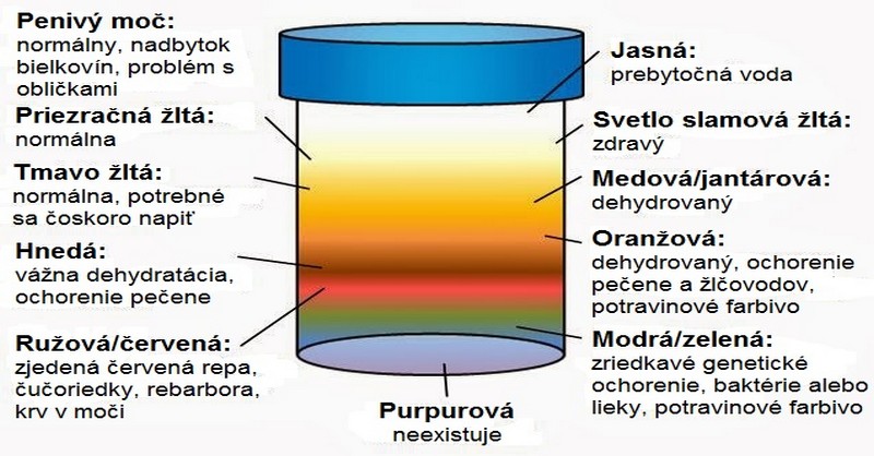 Čo dokáže farba moču prezradiť o vašom zdravotnom stave